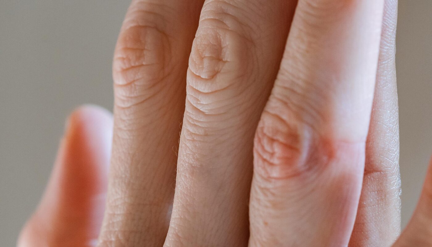 Photo by Angela Roma : https://www.pexels.com/photo/women-gently-touching-palms-for-support-7479655/