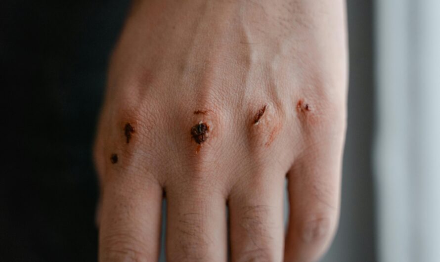 Why Pain Can Exist Without Visible Injury