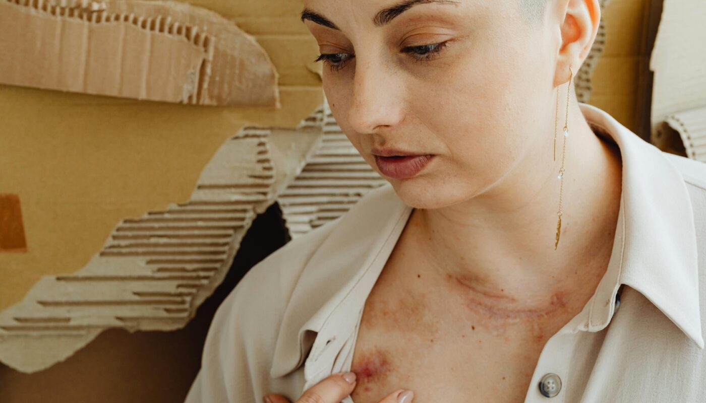 Photo by www.kaboompics.com: https://www.pexels.com/photo/woman-showing-bruises-on-body-7588653/