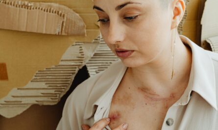 Photo by www.kaboompics.com: https://www.pexels.com/photo/woman-showing-bruises-on-body-7588653/