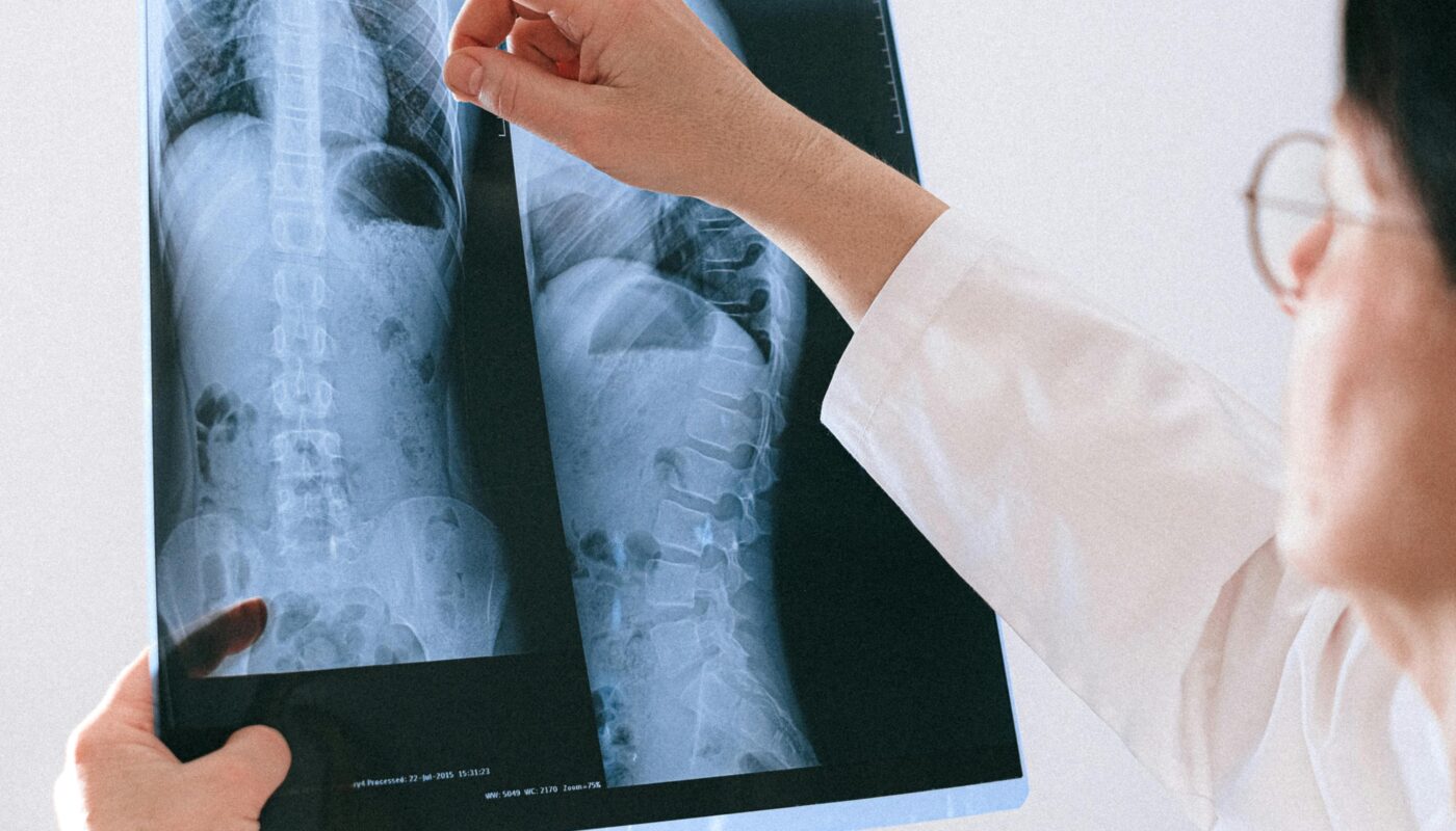 Photo by Anna Shvets: https://www.pexels.com/photo/doctor-looking-at-rtg-picture-4226138/