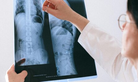 Photo by Anna Shvets: https://www.pexels.com/photo/doctor-looking-at-rtg-picture-4226138/