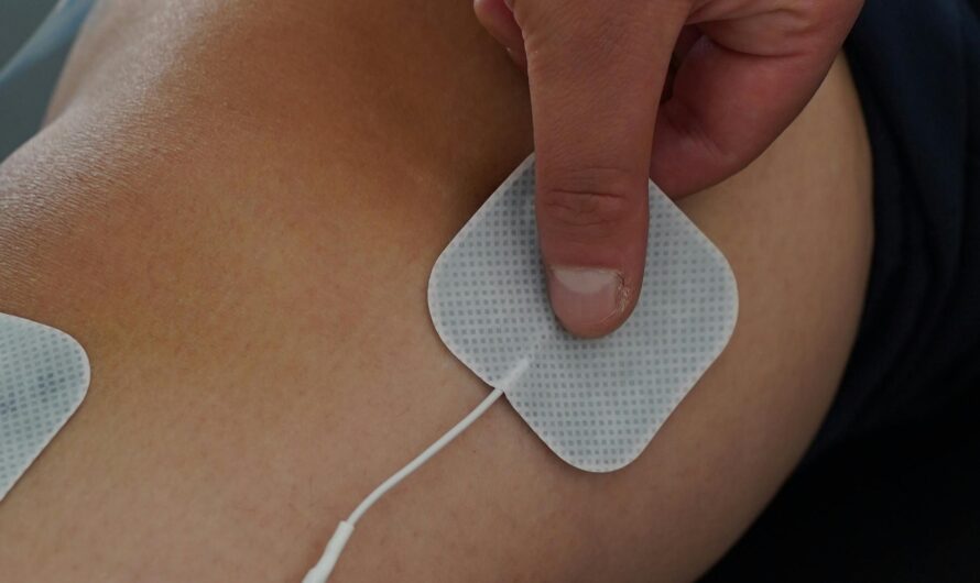 Why Electric Pain Often Travels Along Limbs