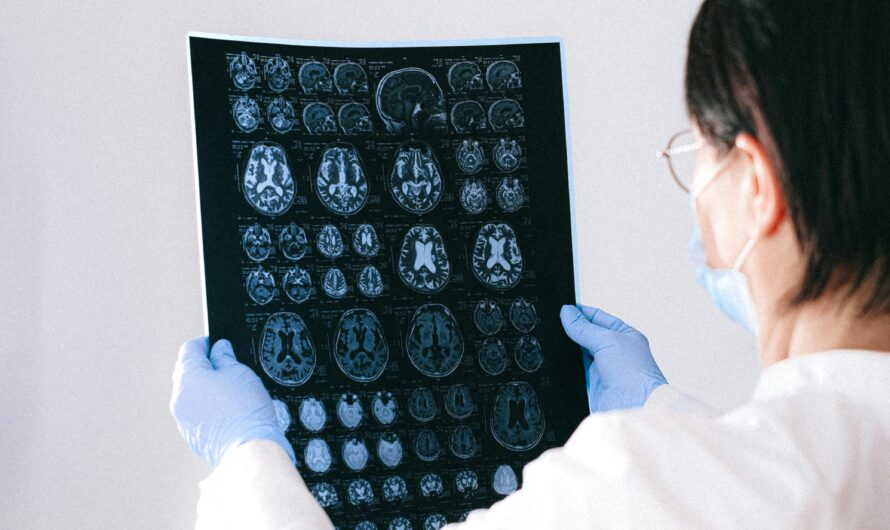 How the Brain Interprets Pain Signals