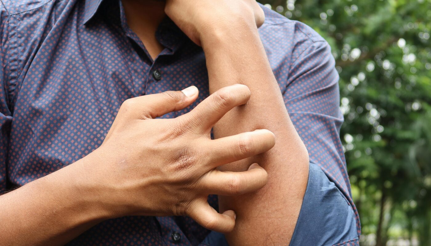Photo by Towfiqu barbhuiya: https://www.pexels.com/photo/man-scratching-a-hand-14387797/