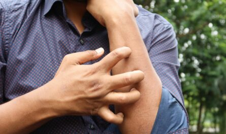 Photo by Towfiqu barbhuiya: https://www.pexels.com/photo/man-scratching-a-hand-14387797/