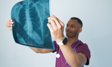 Photo by Daniil Kondrashin: https://www.pexels.com/photo/medical-professional-analyzing-chest-x-ray-32254663/