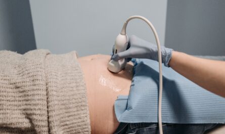 Photo by Pavel Danilyuk: https://www.pexels.com/photo/a-patient-getting-an-ultrasound-7108414/